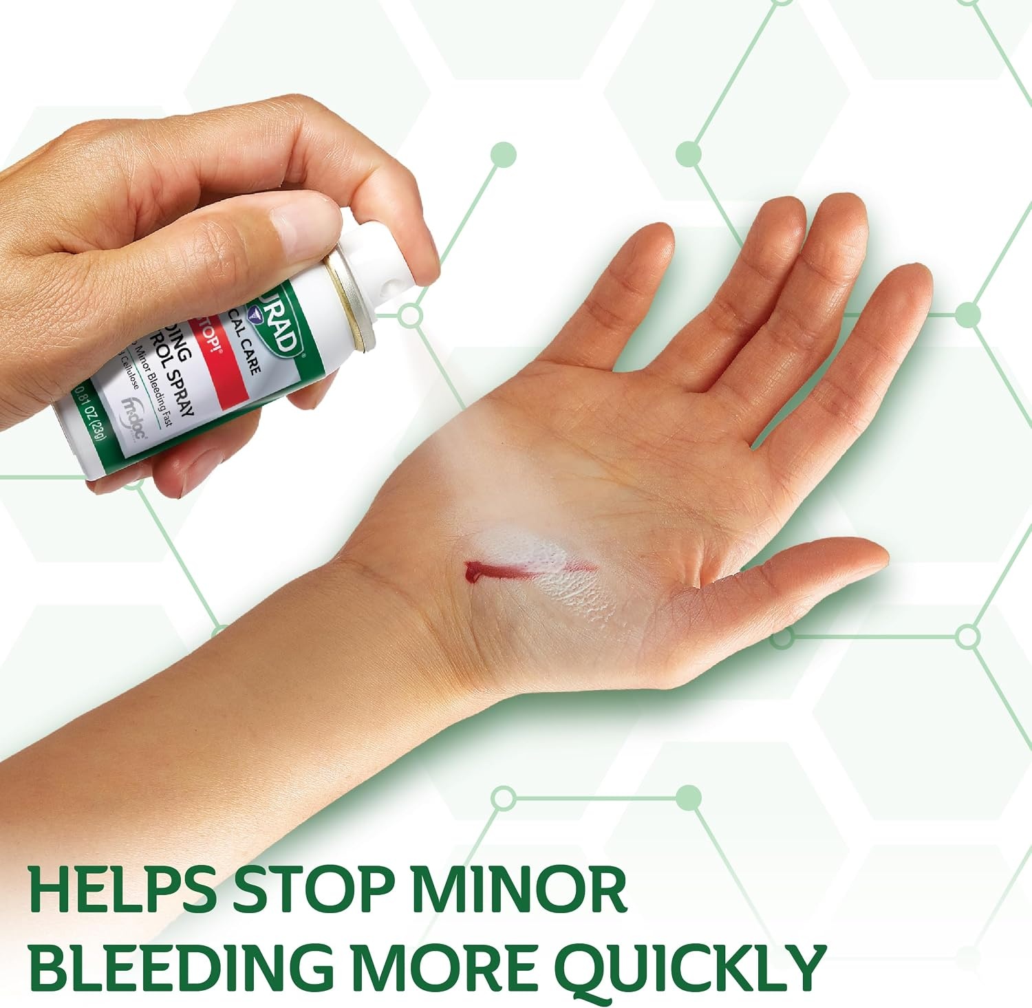 image:imageCURAD QuickStop Bleeding Control Spray 81oz FastActing Solution for Persistent Bleeding For Minor Cuts amp Scrapes 1 Count081 Ounce Pack of 1